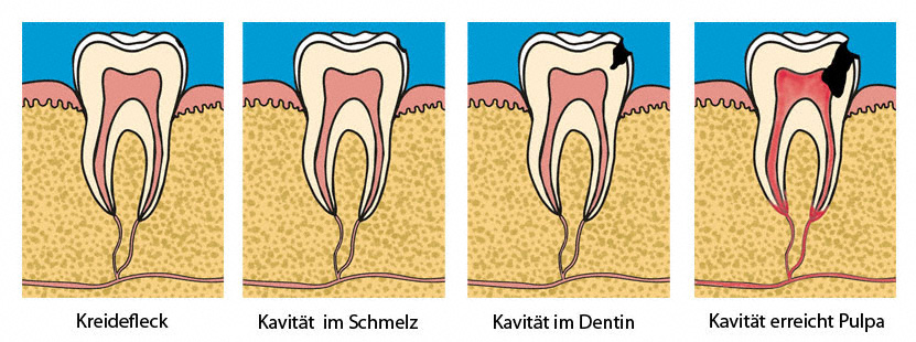 bild4